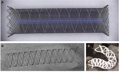 Innovations in intracranial aneurysm treatment: a pilot study on the Choydar flow diverter